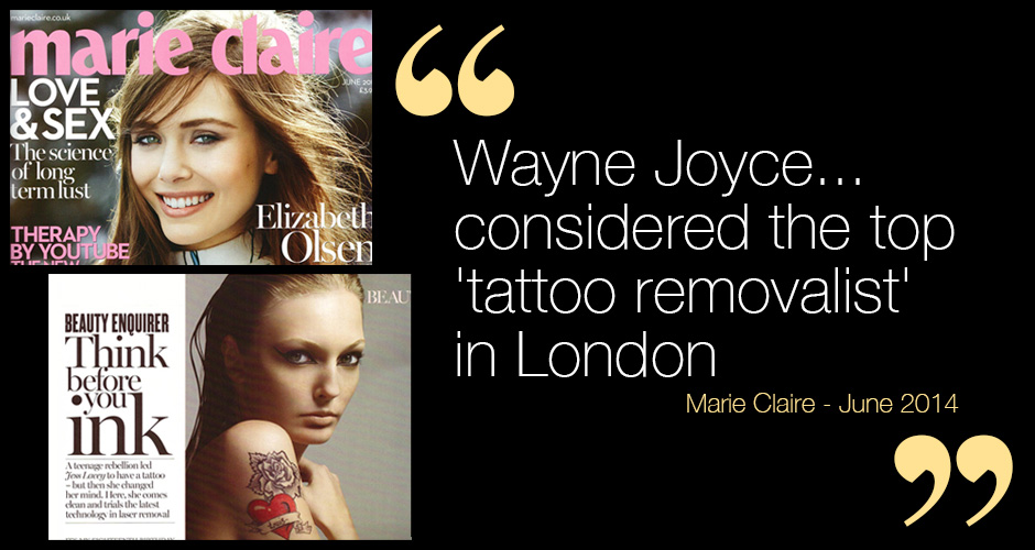 for tattoo removal in a generation whether fading or complete removal ...